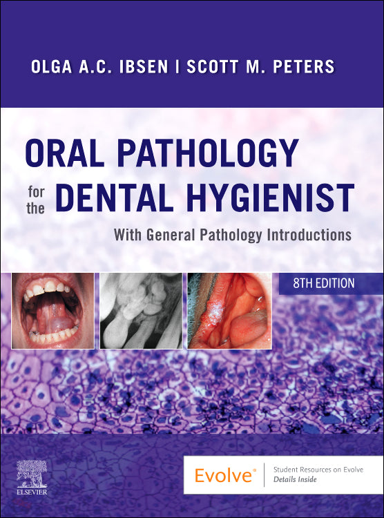 Test Bank for Oral Pathology for the Dental Hygienist 8th Edition by Olga A. C. Ibsen