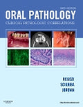 Test Bank for Oral Pathology 6th Edition by Joseph A. Regezi