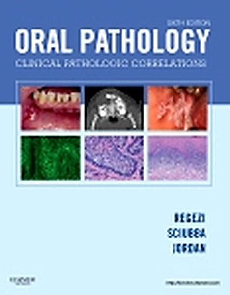 Test Bank for Oral Pathology 6th Edition by Joseph A. Regezi