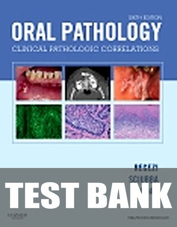 Test Bank for Oral Pathology 6th Edition by Joseph A. Regezi