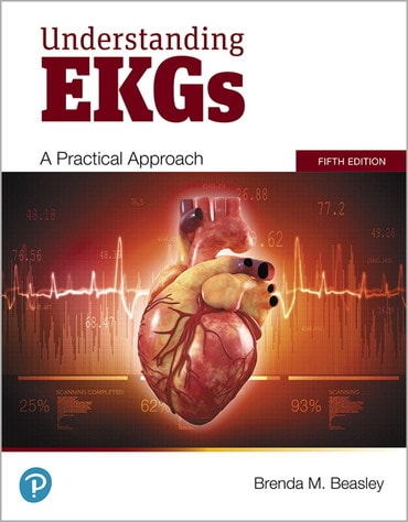Instructor Manual for Understanding EKGs: A Practical Approach 5th Edition by Brenda M. Beasley