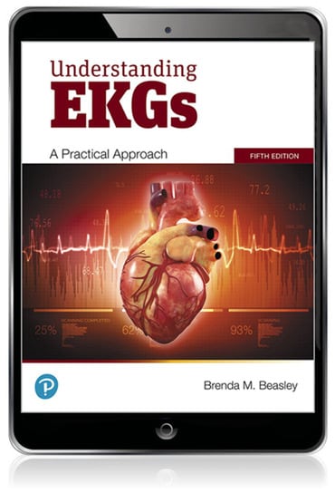 Instructor Manual for Understanding EKGs: A Practical Approach 5th Edition by Brenda M. Beasley